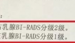 茂医专家说丨乳腺结节不恐慌，没事别总吓自己！