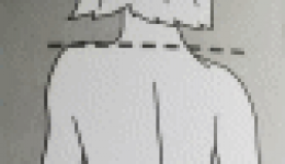 茂医专家说丨儿童脊柱侧弯不容忽视