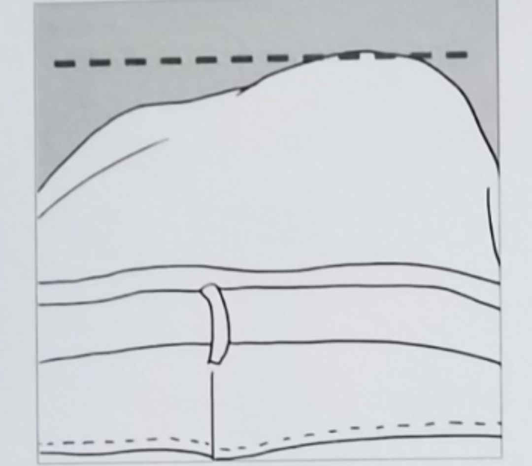 5、腰部一侧有皱褶