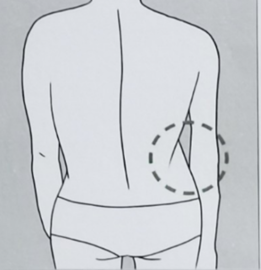 5、腰部一侧有皱褶