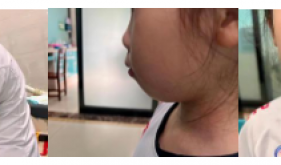 全国爱牙日丨用口呼吸，会变丑？