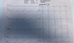 危急！百岁老人突发心梗，茂医30分钟全力救治为他撑开“生命通道”