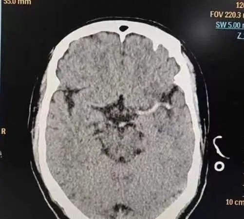 1.入院急诊影像