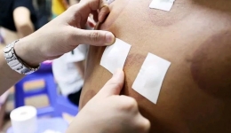 茂医专家说丨冬季如何增强免疫力？