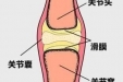茂医专家说丨关节“咔咔”响， 难道是身体出问题了？