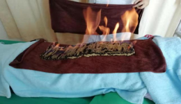 三伏天灸正当时！茂医“灸”友已上线，7月10日开贴啦！