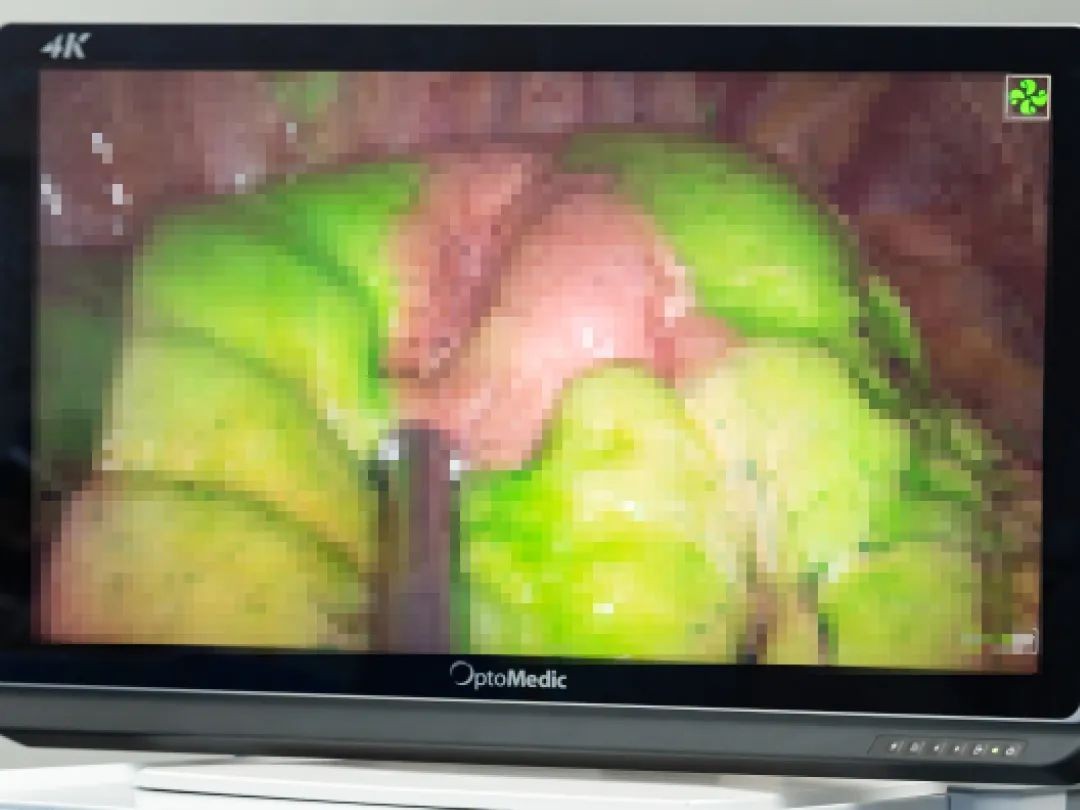 4.荧光镜下显示的流域2.0地图(已打码)