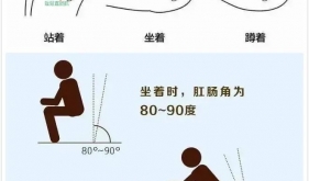 茂医专家说丨“肠话短说”，关于便秘的那点事